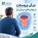بیماری بزرگی پروستات